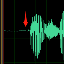 DC-Offset oder Echo