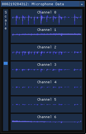 Vue d’entrée du microphone