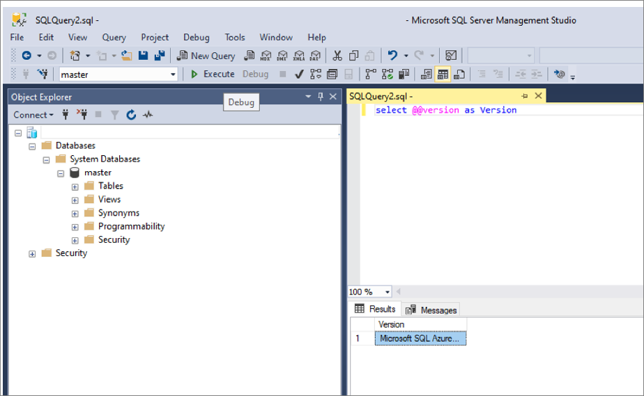 Screenshot che mostra la comparazione dello schema in SQL Server Management Studio.